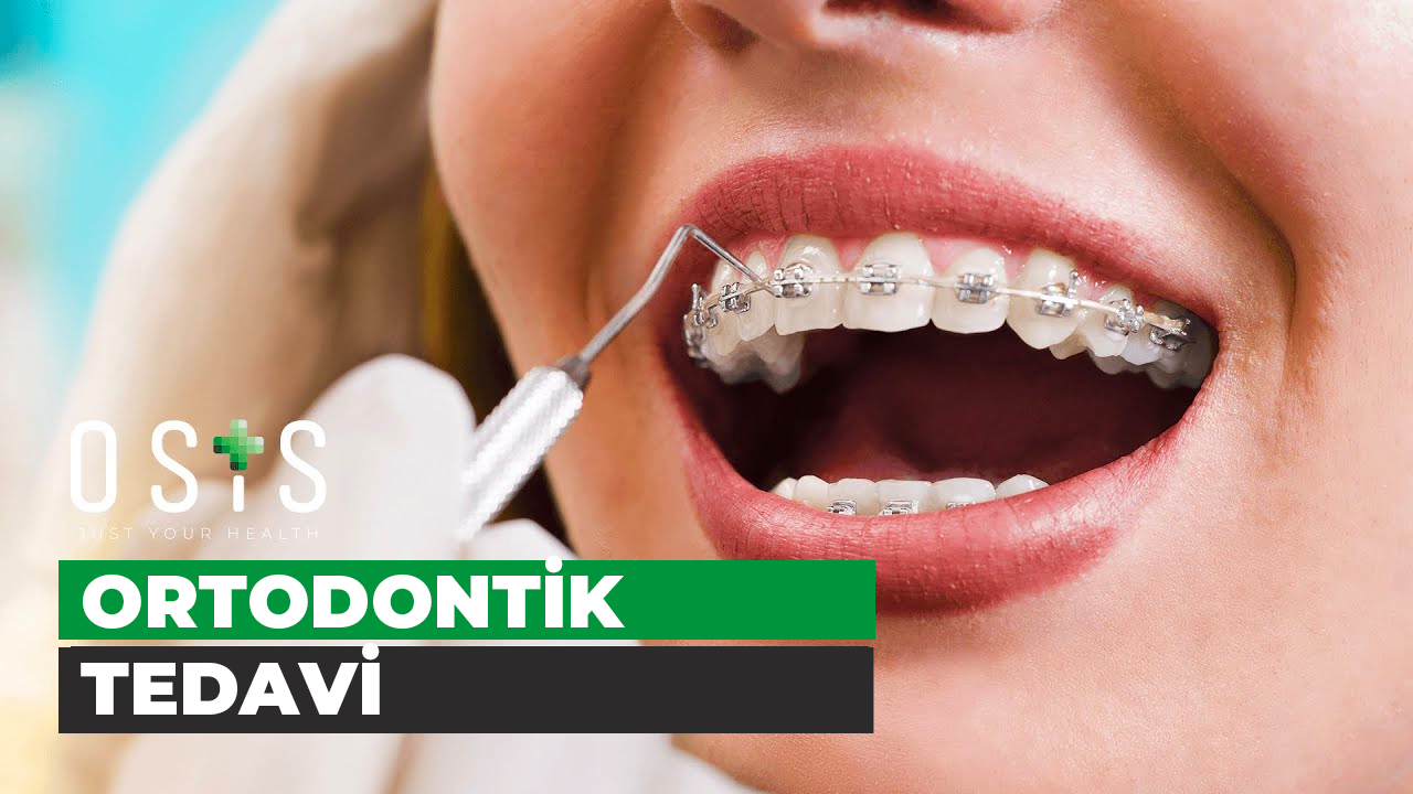 Ortodonti Tedavisi