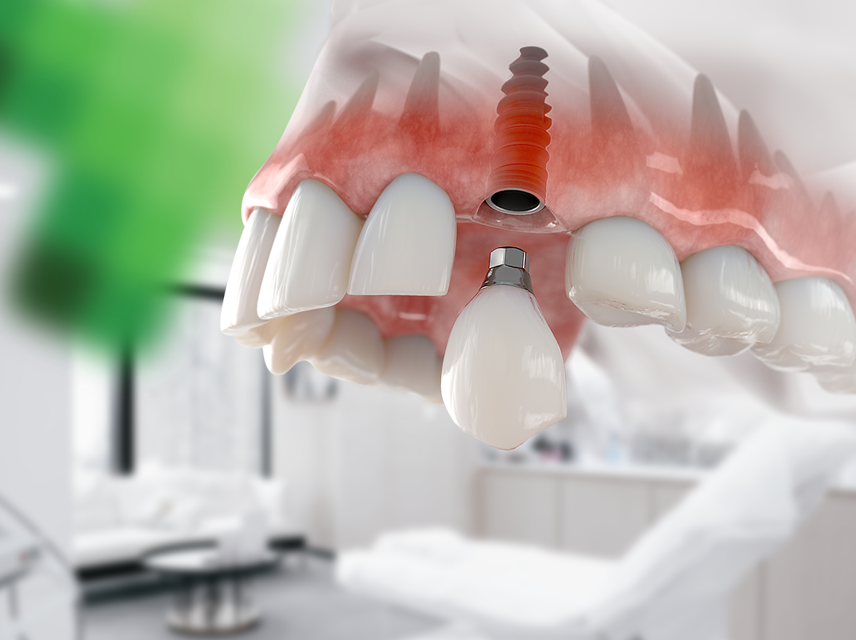 DENTISTERIE GÉNÉRALE